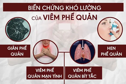 Nếu không phát hiện và chữa trị kịp thời viêm phế quản cấp càng nghiêm trọng